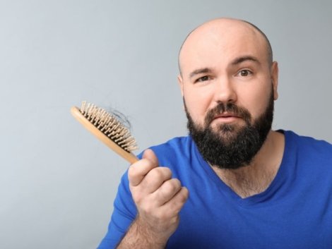 Quando é a Melhor Hora de Fazer Transplante Capilar