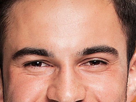 Transplante de Sobrancelhas em Ribeirão Preto_ Resgate a Expressão do seu Olhar