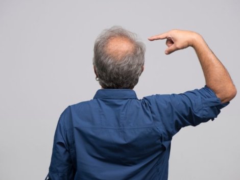 Soluções Personalizadas para Calvície em Ribeirão Preto