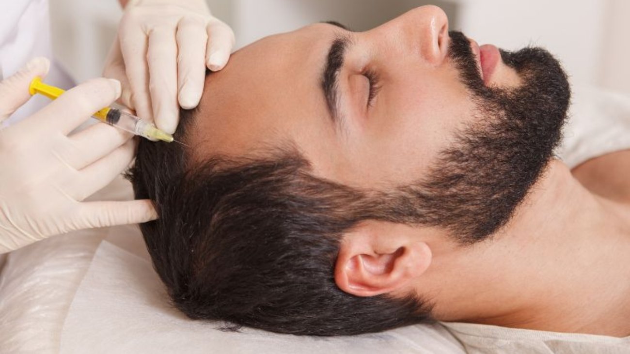Causas e Soluções para Calvície em Ribeirão Preto