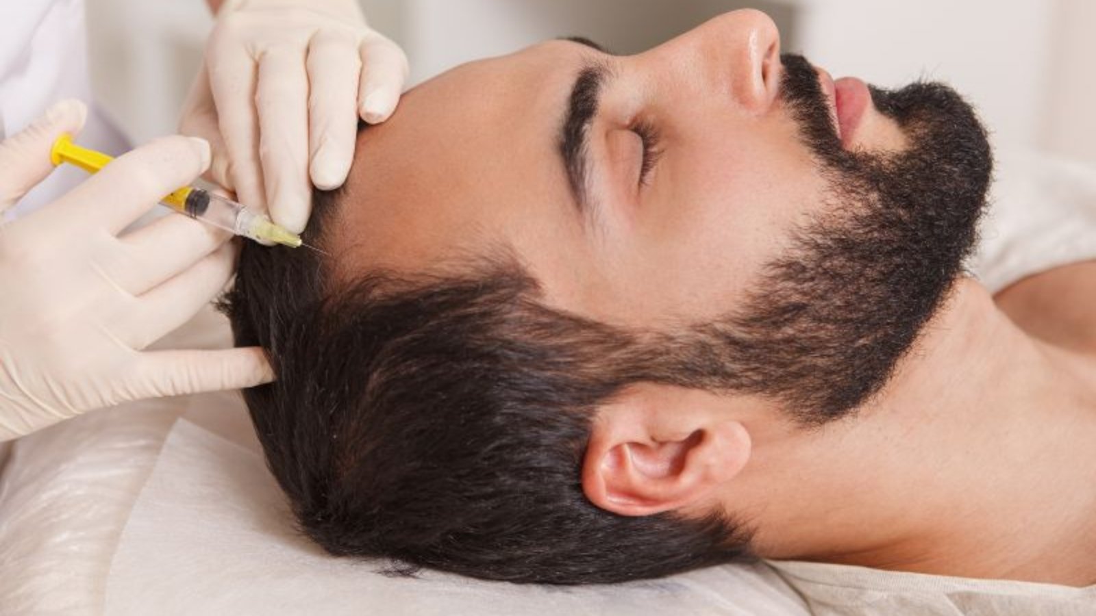 Causas e Soluções para Calvície em Ribeirão Preto