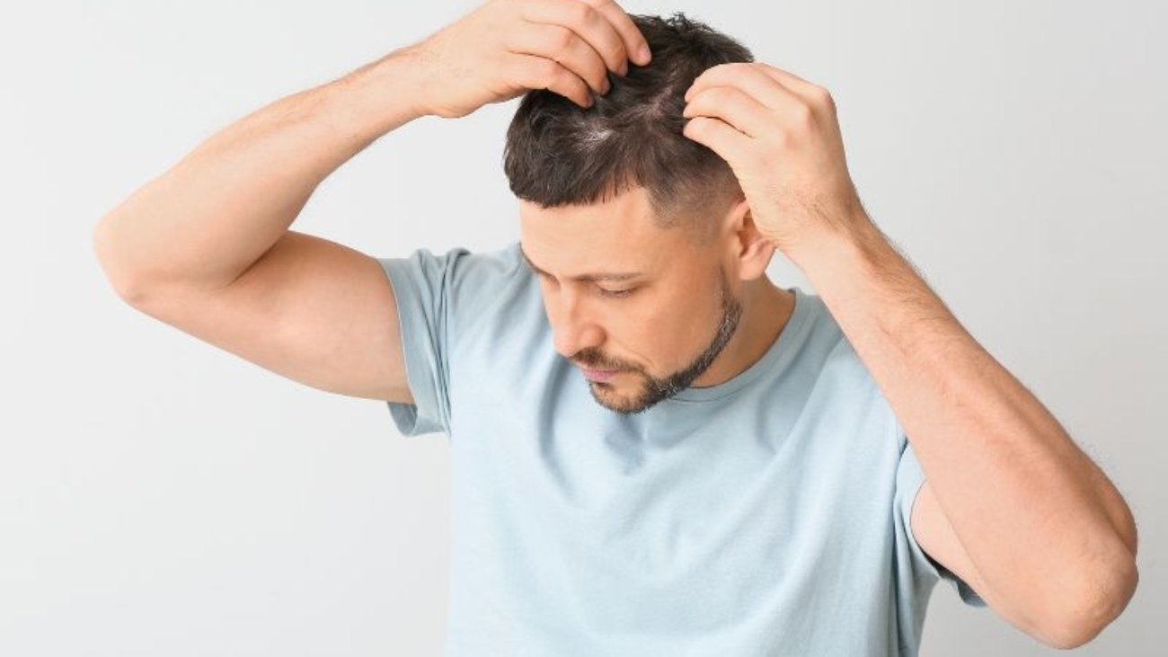 Especialista em Tratamento Capilar FUE em Ribeirão Preto