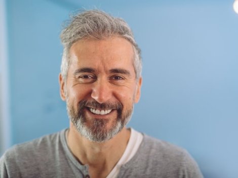 Técnica FUE para Calvície Masculina em Ribeirão Preto